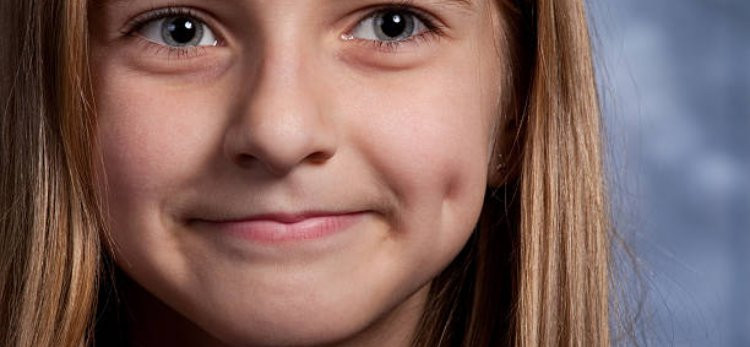 Dimple Surgery Consultation: Questions to Ask Your Surgeon