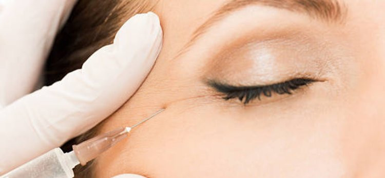 How to Prepare for Botox Injections