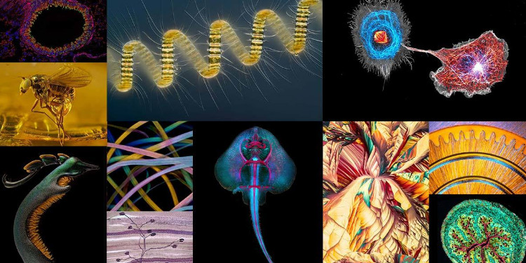 Nikon 2021 Mikroskopik Fotoğraf Yarışması