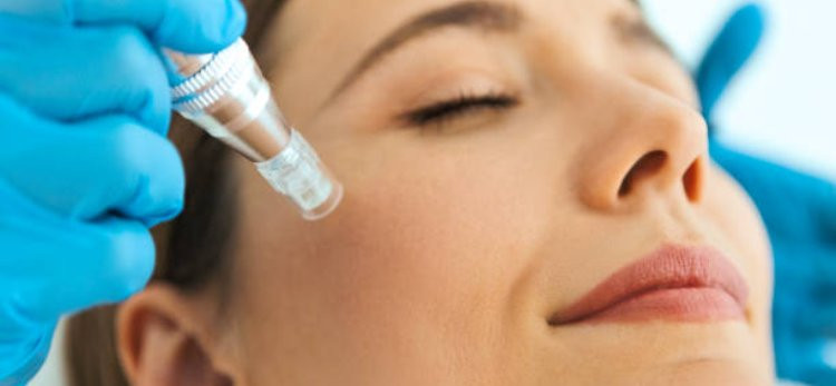 Understanding the Skin Benefits of Plasma Pen Treatment