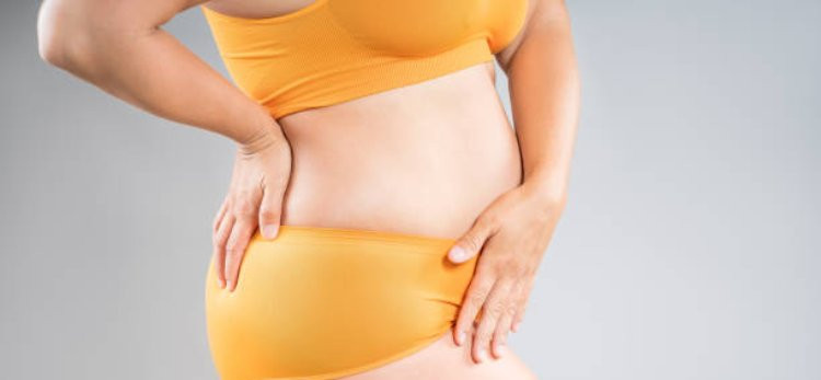 What Factors Affect the Cost of a Liposuction Procedure?